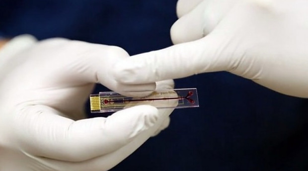 Имплантат измерит содержание лекарственных препаратов в крови человека - «Технологии»