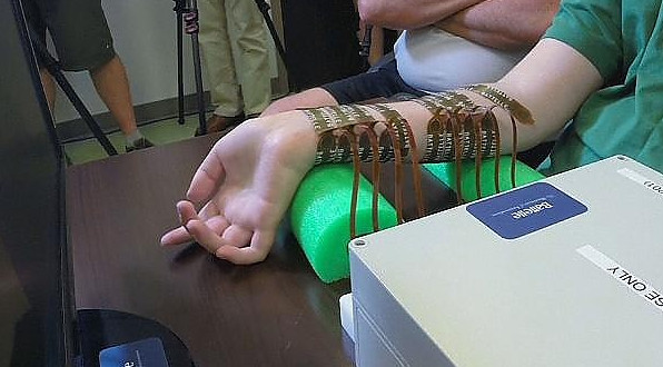 Neirobridge поможет парализованным обрести способность двигаться - «Технологии»